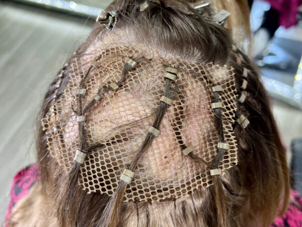 Mesh Integration Hair Loss Solution Phoenix AZ Mesh Integration Hair Loss Solution Phoenix AZ