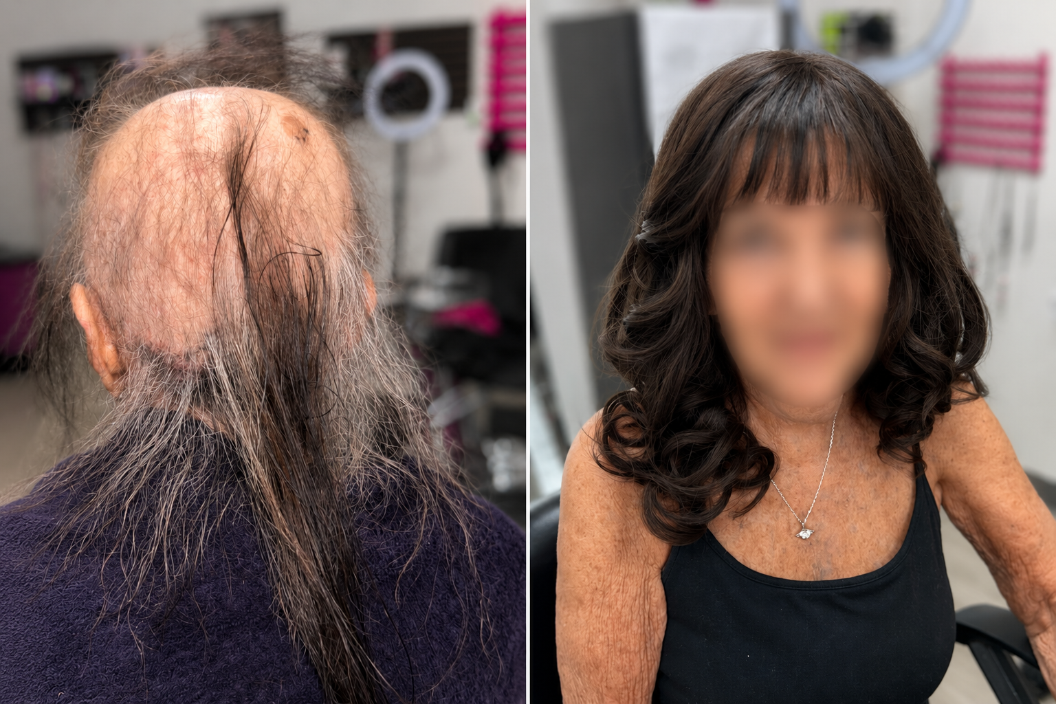 Before and after mesh integration hair loss transformation by LTBHair, a Hair Loss Specialist in Phoenix, Arizona.