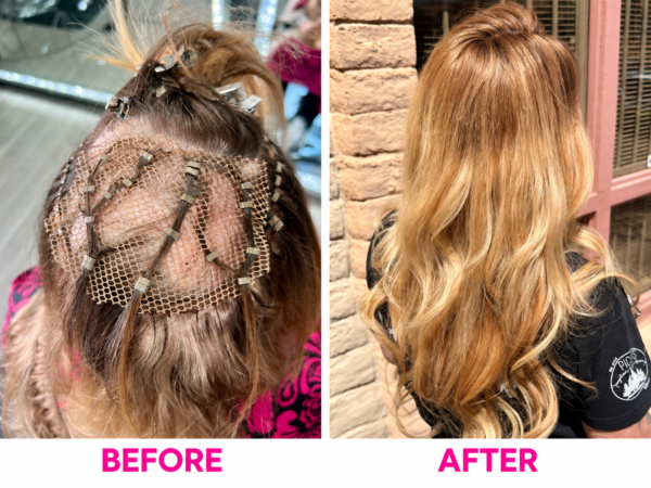 Before and after Mesh Integration hair restoration at LTBHair in Phoenix