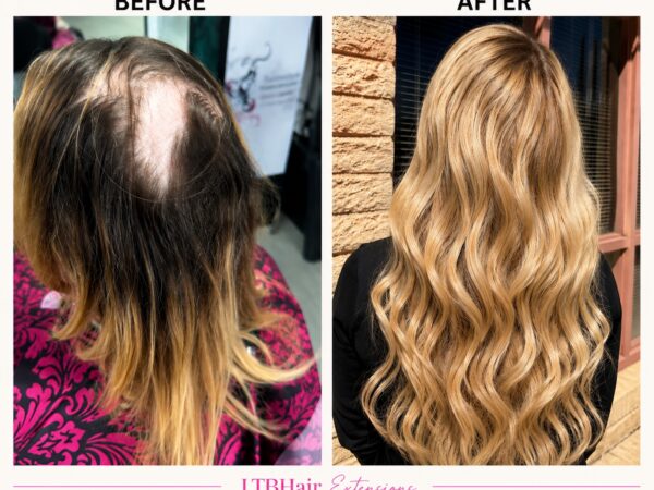 Before and after mesh integration for a Phoenix hair loss client with crown thinning